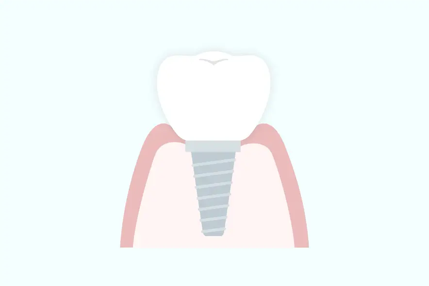 噛める楽しみ、食べる楽しみを取り戻す